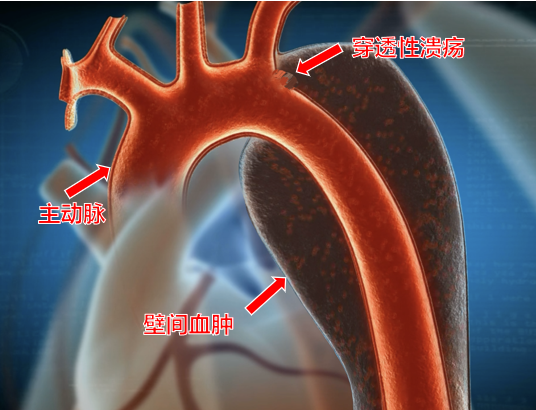 正文图片 正文图片