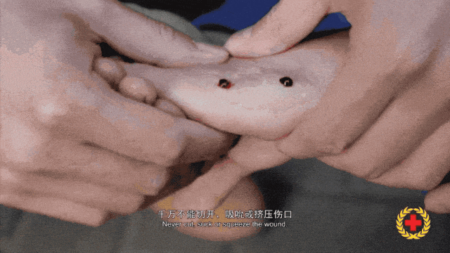 正文图片