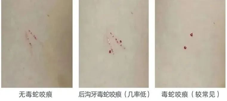 正文图片