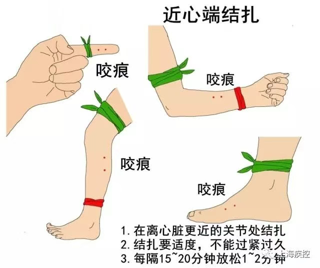 正文图片